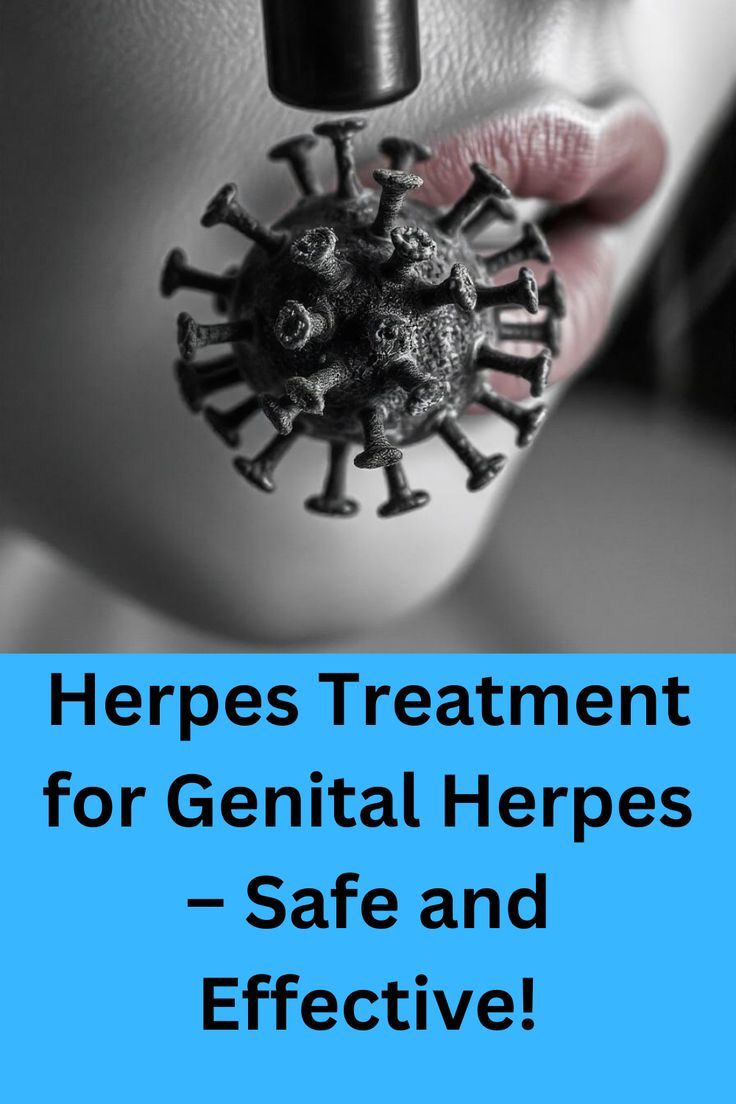 Say goodbye to outbreaks naturally! 🌿✨